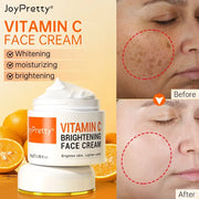 Vitamin C for Face Cream Pigments Dark Spots Removal Whitening Facial Cream Lightening Skin Care Products Beauty Health